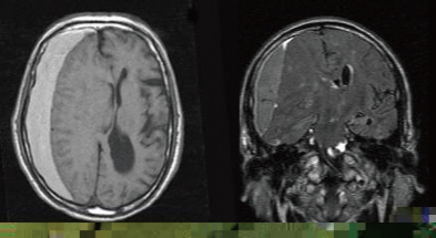 頭部CT・MRI